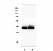 Western blot testing of 1) rat skeletal muscle and 2) mouse skeletal muscle lysate with TNNI2 antibody. Predicted molecular weight: ~21 kDa.