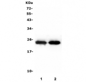 Western blot testing of 1) rat skeletal muscle and 2) mouse skeletal muscle lysate with TNNI2 antibody. Predicted molecular weight: ~21 kDa, observed here at ~25 kDa.