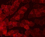 Immunofluorescent staining of FFPE mouse skeletal muscle tissue with TNNI2 antibody. HIER: boil tissue sections in pH8 EDTA for 20 min and allow to cool before testing.