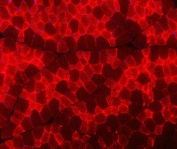 Immunofluorescent staining of FFPE rat skeletal muscle tissue with TNNI2 antibody. HIER: boil tissue sections in pH8 EDTA for 20 min and allow to cool before testing.