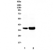 Western blot testing of 1) rat skeletal muscle and 2) mouse skeletal muscle with TNNT3 antibody. Predicted molecular weight: ~32 kDa, routinely observed at 35~38 kDa.