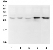 Western blot testing of human 1) HEK293, 2) HeLa, 3) HepG2, 4) Jurkat and 5) Raji cell lysate with DCK antibody. Predicted molecular weight ~30 kDa.