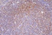 IHC staining of FFPE human tonsil with DCK antibody. HIER: boil tissue sections in pH8 EDTA buffer, for 20 min and allow to cool before testing.