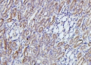 IHC staining of FFPE rat kidney with TRPV5 antibody. HIER: boil tissue sections in pH6, 10mM citrate buffer, for 20 min and allow to cool before testing.