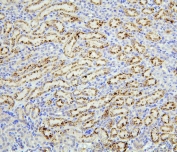 IHC staining of FFPE mouse kidney with TRPV5 antibody. HIER: boil tissue sections in pH6, 10mM citrate buffer, for 20 min and allow to cool before testing.