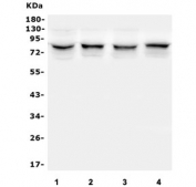 Western blot testing of 1) monkey COS-7, 2) human U-87 MG, 3) human HeLa and 4) human HepG2 lysate with TRPV5 antibody. Western blot testing of human pancreas lysate with TRPV5 antibody at 1ug/ml. Predicted/observed molecular weight: ~85 kDa.