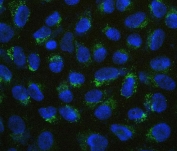 Immunofluorescent staining of FFPPE human U-2 OS cells with B7H4 antibody (green) and DAPI nuclear stain (blue). HIER: boil tissue sections in pH6, 10mM citrate buffer, for 20 min and allow to cool before testing.