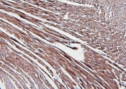 IHC staining of FFPE rat heart with Aldolase A antibody. HIER: boil tissue sections in pH6, 10mM citrate buffer, for 20 min and allow to cool before testing.