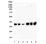 Western blot testing of human 1) placenta, 2) A431, 3) HepG2, 4) A549, 5) U-937 and 6) PC-3 lysate with Aldolase A antibody.