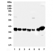Western blot testing of rat 1) thymus, 2) spleen, 3) lung, 4) kidney and mouse 5) thymus, 6) kidney and 7) mouse Ana-1 cell lysate with Aldolase A antibody.