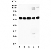 Western blot testing of human 1) A549, 2) A431, 3) HEK293, 4) ThP-1 and 5) Caco-2 cell lysate with AVPR1A antibody. Expected molecular weight: 47-85 kDa depending on glycosylation level.