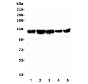 Western blot testing of human 1) HL-60, 2) HEK293, 3) MDA-MB-453, 4) Caco-2 and 5) PC-3 cell lysate with BubR1 antibody. Predicted molecular weight ~120 kDa.