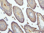 IHC staining of FFPE mouse testis with BubR1 antibody. HIER: boil tissue sections in pH6, 10mM citrate buffer, for 20 min and allow to cool before testing.