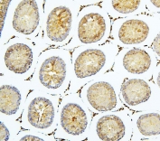 IHC staining of FFPE rat testis with BubR1 antibody. HIER: boil tissue sections in pH6, 10mM citrate buffer, for 20 min and allow to cool before testing.