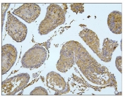IHC staining of FFPE rat testis tissue with BubR1 antibody. HIER: boil tissue sections in pH8 EDTA buffer for 20 min and allow to cool before testing.