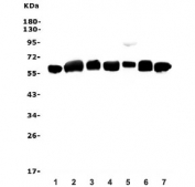 Western blot testing of human 1) U-87 MG, 2) U-937, 3) HepG2, 4) ThP-1, 5) T-47D and 6) PC-3 cell lysate with Calreticulin antibody. Predicted molecular weight ~48 kDa but routinely observed at 55~60 kDa.