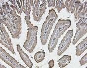 IHC staining of FFPE mouse intestine with Calreticulin antibody. HIER: boil tissue sections in pH6, 10mM citrate buffer, for 20 min and allow to cool before testing.