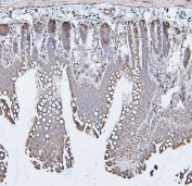 IHC staining of FFPE rat intestine with Calreticulin antibody. HIER: boil tissue sections in pH6, 10mM citrate buffer, for 20 min and allow to cool before testing.