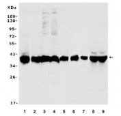Western blot testing of human 1) K562, 2) HepG2, 3) ThP-1, 4) HEK293, 5) PC-3, 6) rat liver, 7) mouse liver, 8) monkey liver, 9) monkey kidney lysate with Aldolase B antibody. Predicted molecular weight ~39 kDa.