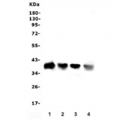 Western blot testing of 1) rat liver, 2) rat kidney, 3) mouse liver and 4) mouse kidney lysate with Aldolase B antibody. Predicted molecular weight ~39 kDa.