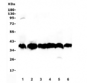 Western blot testing of human 1) placenta, 2) K562, 3) HepG2, 4) ThP-1, 5) HEK293 and 6) PC-3 lysate with Aldolase B antibody. Predicted molecular weight ~39 kDa.