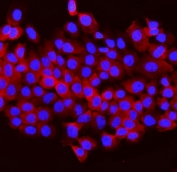 Immunofluorescent staining of FFPE human A431 cells with Aldolase B antibody (red) and DAPI nuclear stain (blue). HIER: steam section in pH6 citrate buffer for 20 min.