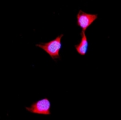 Immunofluorescent staining of FFPE human U-2 OS cells with Aldolase B antibody (red) and DAPI nuclear stain (blue). HIER: steam section in pH6 citrate buffer for 20 min.