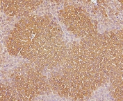 IHC staining of FFPE mouse liver with CYP2E1 antibody. HIER: boil tissue sections in pH6, 10mM citrate buffer, for 20 min and allow to cool before testing.