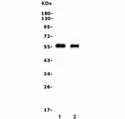 Western blot testing of 1) rat liver and 2) mouse liver lysate with CYP2E1 antibody. Predicted molecular weight ~57 kDa.