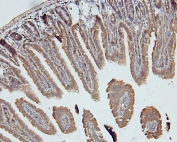 IHC staining of FFPE mouse intestine with DDR1 antibody. HIER: boil tissue sections in pH6, 10mM citrate buffer, for 20 min and allow to cool before testing.