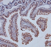 IHC staining of FFPE rat intestine with DDR1 antibody. HIER: boil tissue sections in pH6, 10mM citrate buffer, for 20 min and allow to cool before testing.