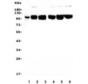 Western blot testing of human 1) placenta, 2) A549, 3) K562, 4) HepG2, 5) PC-3 and 6) ThP-1 lysate with DDR1 antibody. Expected molecular weight: 100~125 kDa.