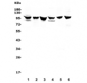 Western blot testing of 1) rat brain, 2) rat lung, 3) rat testis, 4) mouse brain, 5) mouse lung and 6) mouse testis lysate with DDR1 antibody. Expected molecular weight: 100~125 kDa.