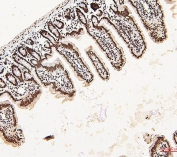 IHC staining of FFPE mouse small intestine with DDX5 antibody. HIER: boil tissue sections in pH6, 10mM citrate buffer, for 20 min and allow to cool before testing.