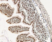 IHC staining of FFPE rat small intestine with DDX5 antibody. HIER: boil tissue sections in pH6, 10mM citrate buffer, for 20 min and allow to cool before testing.