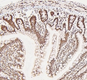 IHC staining of FFPE rat small intestine with DDX5 antibody. HIER: boil tissue sections in pH6, 10mM citrate buffer, for 20 min and allow to cool before testing.