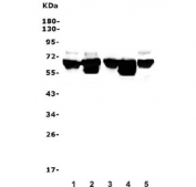 Western blot testing of 1) rat brain, 2) rat thymus, 3) mouse brain, 4) mouse thymus and 6) mouse NIH 3T3 lysate with DDX5 antibody. Predicted molecular weight: ~68 kDa.