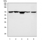 Western blot testing of 1) human A431, 2) human SH-SY5Y, 3) human 293T, 4) rat brain and 5) mouse brain tissue lysate with DDX5 antibody. Predicted molecular weight: ~68 kDa.