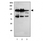 Western blot testing of human 1) K562, 2) SH-SY5Y and 3) Jurkat cell lysate with Exonuclease 1 antibody. Expected molecular weight: 94-115 kDa.