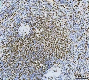 IHC staining of FFPE human spleen tissue with Exonuclease 1 antibody. HIER: boil tissue sections in pH8 EDTA for 20 min and allow to cool before testing.