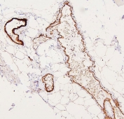 IHC staining of FFPE human skeletal muscle with Filamin A antibody. HIER: boil tissue sections in pH6, 10mM citrate buffer, for 20 min and allow to cool before testing.
