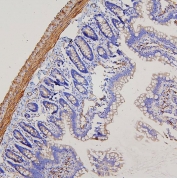 IHC staining of FFPE rat intestine with Filamin A antibody. HIER: boil tissue sections in pH6, 10mM citrate buffer, for 20 min and allow to cool before testing.