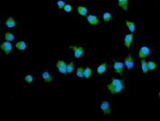 Immunofluorescent staining of FFPE human A549 cells with Filamin A antibody (green) and DAPI (blue). HIER: boil tissue sections in pH6, 10mM citrate buffer, for 20 min and allow to cool before testing.