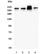 Western blot testing of human 1) A549, 2) U-2 OS, 3) HeLa and 4) PC-3 lysate with Filamin A antibody. Predicted molecular weight ~281 kDa.