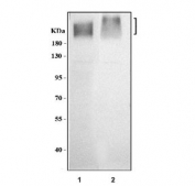 Western blot testing of 1) rat brain and 2) mouse brain lysate with GRM2 antibody. Predicted molecular weight ~96 kDa, routinely observed at 110-120 kDa (monomer) and 220-240 kDa (dimer).