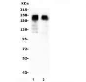 Western blot testing of 1) rat brain and 2) mouse brain lysate with GRM2 antibody. Predicted molecular weight ~96 kDa, routinely observed at 110-120 kDa (monomer) and 220-240 kDa (dimer).