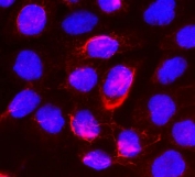 Immunofluorescent staining of FFEP human A431 cells with Beta Glucuronidase antibody (red) and DAPI nuclear stain (blue). HIER: boil tissue sections in pH 9 10mM Tris with 1mM EDTA for 20 min and allow to cool before testing.