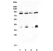 Western blot testing of human 1) K562, 2) Caco-2, 3) U-87 MG and 4) HepG2 cell lysate with Beta Glucuronidase antibody. Expected molecular weight: 68-75 kDa, also seen as dimers and tetramers.