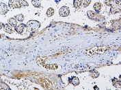 IHC staining of FFPE human placenta with CETP antibody. HIER: boil tissue sections in pH6, 10mM citrate buffer, for 20 min and allow to cool before testing.