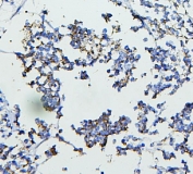 IHC staining of FFPE human appendicitis tissue with CETP antibody. HIER: boil tissue sections in pH6, 10mM citrate buffer, for 20 min and allow to cool before testing.